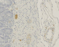 Immunohistochemistry detection of Alpha-calcitonin gene-related peptide (α-CGRP) in rat tissue tissue using Anti-Alpha-Calcitonin Gene-Related Peptide (alpha-CGRP) Antibody (Cat. ABS 026-010-010). Tissue was mounted and pariffin fixed. Heat induced antigen retrieval was performed using citrate buffer, heated, and then blocked. After washing, the primary antibody (Cat. ABS 026-010-010) was incubated with the sample.