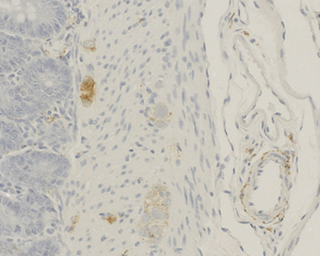 Immunohistochemistry detection of Alpha-calcitonin gene-related peptide (α-CGRP) in rat tissue tissue using Anti-Alpha-Calcitonin Gene-Related Peptide (alpha-CGRP) Antibody (Cat. ABS 026-010-010). Tissue was mounted and pariffin fixed. Heat induced antigen retrieval was performed using citrate buffer, heated, and then blocked. After washing, the primary antibody (Cat. ABS 026-010-010) was incubated with the sample.