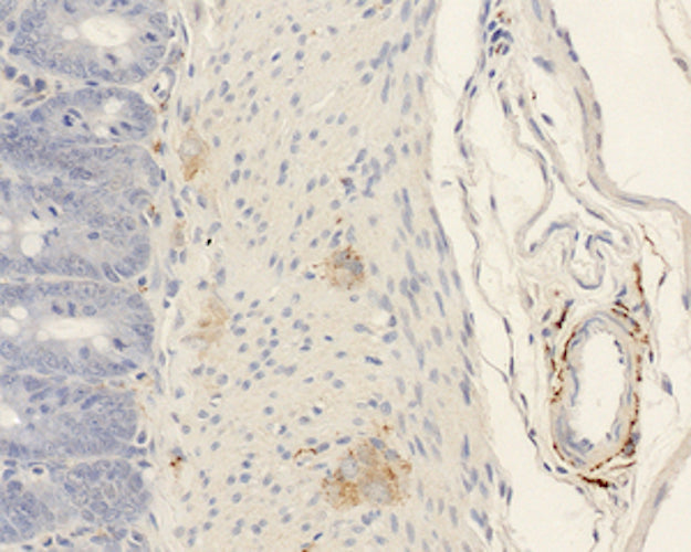 Immunohistochemistry detection of Alpha-calcitonin gene-related peptide (α-CGRP) in rat tissue tissue using Anti-Alpha-Calcitonin Gene-Related Peptide (alpha-CGRP) Antibody (Cat. ABS 026-05-010). Tissue was mounted and pariffin fixed. Heat induced antigen retrieval was performed using citrate buffer, heated, and then blocked. After washing, the primary antibody (Cat. ABS 026-05-010) was incubated with the sample.