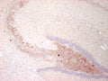 Immunohistochemistry detection of Neuropeptide Y in mouse brain tissue using Anti-Neuropeptide Y Antibody (Cat. ABS 028-08-010). Tissue was mounted and pariffin fixed. Heat induced antigen retrieval was performed using citrate buffer, heated, and then blocked. After washing, the primary antibody (Cat. ABS 028-08-010) was incubated with the sample at a dilution of 1:1000. Staining of fibres in the hilus of the hippocampus from a mouse suffering an epiletic attack.