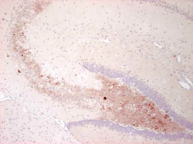 Immunohistochemistry detection of Neuropeptide Y in mouse brain tissue using Anti-Neuropeptide Y Antibody (Cat. ABS 028-08-010). Tissue was mounted and pariffin fixed. Heat induced antigen retrieval was performed using citrate buffer, heated, and then blocked. After washing, the primary antibody (Cat. ABS 028-08-010) was incubated with the sample at a dilution of 1:1000. Staining of fibres in the hilus of the hippocampus from a mouse suffering an epiletic attack.