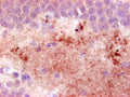 Immunohistochemistry detection of Neuropeptide Y in mouse hippocampus tissue using Anti-Neuropeptide Y Antibody (Cat. ABS 028-08-010). Tissue was mounted and pariffin fixed. Heat induced antigen retrieval was performed using citrate buffer, heated, and then blocked. After washing, the primary antibody (Cat. ABS 028-08-010) was incubated with the sample at a dilution of 1:1000. Staining of fibres in the hilus of the hippocampus from a mouse suffering an epileptic attack.