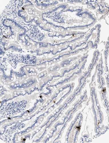 Immunohistochemistry detection of Peptide YY in human small intestine tissue using Anti-Peptide YY Antibody (Cat. ABS 029-01-010). Tissue was mounted and pariffin fixed. Heat induced antigen retrieval was performed using citrate buffer, heated, and then blocked. After washing, the primary antibody (Cat. ABS 029-01-010) was incubated with the sample.