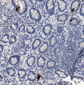 Immunohistochemistry detection of Peptide YY in human small intestine tissue using Anti-Peptide YY Antibody (Cat. ABS 029-01-010). Tissue was mounted and pariffin fixed. Heat induced antigen retrieval was performed using citrate buffer, heated, and then blocked. After washing, the primary antibody (Cat. ABS 029-01-010) was incubated with the sample.