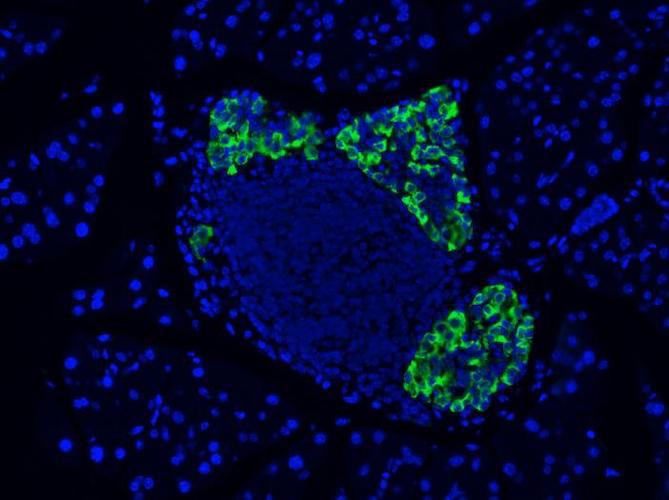 Immunohistochemistry detection of GLP-1(7-37) and GLP-1(7-36) amide (N-term) in Mouse endocrine tissue using Anti-GLP-1 (7-37) and GLP-1 (7-36) amide (N-term) Antibody (Cat. ABS 033-04-010). Tissue was mounted and pariffin fixed. Heat induced antigen retrieval was performed using citrate buffer, heated, and then blocked. After washing, the primary antibody (Cat. ABS 033-04-010) was incubated with the sample at a dilution of 1:500. Courtesy of Dr. Annette Plesner, University of British Columbia.