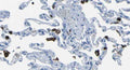 Immunohistochemistry detection of M-Ficolin in human lung tissue using Anti-M-Ficolin Antibody (Cat. ABS 036-01-010). Tissue was mounted and pariffin fixed. Heat induced antigen retrieval was performed using citrate buffer, heated, and then blocked. After washing, the primary antibody (Cat. ABS 036-01-010) was incubated with the sample.