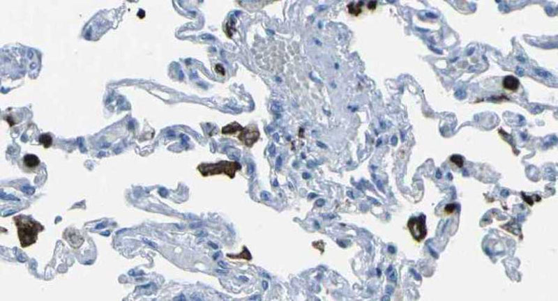Immunohistochemistry detection of M-Ficolin in human lung tissue using Anti-M-Ficolin Antibody (Cat. ABS 036-01-010). Tissue was mounted and pariffin fixed. Heat induced antigen retrieval was performed using citrate buffer, heated, and then blocked. After washing, the primary antibody (Cat. ABS 036-01-010) was incubated with the sample.