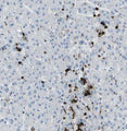 Immunohistochemistry detection of M-Ficolin in human lung tissue using Anti-M-Ficolin Antibody (Cat. ABS 036-01-010). Tissue was mounted and pariffin fixed. Heat induced antigen retrieval was performed using citrate buffer, heated, and then blocked. After washing, the primary antibody (Cat. ABS 036-01-010) was incubated with the sample.