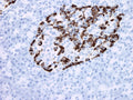 Anti-Glucagon Antibody