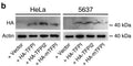 TFPI, TFPI2, and mTFPI were expressed in HeLa or 5637 cells via lentiviral transduction. Expressed exogenous TFPI proteins in cells were confirmed via immunoblot detecting the triple HA tag (Cat. ET-HA) fused to their N-termini. Actin (Cat. ACT) was used as a loading control. Image from publication CC-BY-4.0. PMID: 36351897