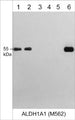 Western blot image of human A431 (lane 1), HepG2 (lane 2), PC3 (lane 3), Jurkat (lane 4), bovine tubulin (lane 5), and recombinant human ALDH1A1 (lane 6). The blot was probed with mouse monoclonal ALDH1A1 M562 (lanes 1-6) at a dilution of 1:1,000.