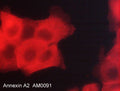 Immunocytochemical labeling of Annexin A2 in paraformaldehyde fixed human A431 cells. The cells were labeled with mouse monoclonal anti-Annexin A2 (clone M009). The antibody was detected using goat anti-mouse DyLight® 594.