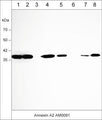 Western blot of human A431 (lane 1), MDA-MB-231 (lane 2), LNCaP (lane 3), MeWo (lane 4), HUVEC (lane 5), Jurkat (lane 6), K562 (lane 7), and PC3 (lane 8) cell lysates. The blot was probed with mouse monoclonal anti-Annexin A2 antibody (AM0091) at 1:500 (lanes 1-8).