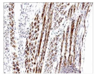 Formalin fixed, citric acid treated paraffin sections of E16 mouse skeletal muscle. Sections were probed with anti-Atrogin-1 (AP2041) then anti-Rabbit:HRP before detection using DAB. (Images provided by Carl Hobbs and Dr. Pat Doherty at Wolfson Centre for Age-Related Diseases, King's College London).