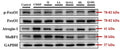 The individual and combined effect of quercetin (Q) and low dose (LL) or high dose (HL) of leucine on relative protein expression of p-FoxO1/FoxO1, Atrogin-1 (Cat. AP2041), and MuRF1 (Cat. MP3401) in the gastrocnemius muscle in BALB/c mice exposed to cisplatin (CDDP). Image from publication CC-BY-4.0. PMID: 37699022