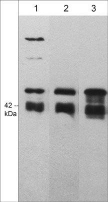 Western blot of human A431 (lane 1), Jurkat (lane 2), and HeLa (lane 3) cells. The blots were probed with rabbit polyclonal anti-Arp3 (C-terminal region) antibody at 1:1000 (lanes 1-3).
