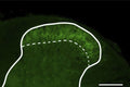 Distribution of α2δ-1 subunit in spinal dorsal horn. The spinal dorsal horn sections of CV mice were stained with anti-α2δ-1 antibody (green). Scale bar = 200 µm. Solid line represents the gray matter border, dotted line represents the superficial layer. Sections mounted with Fluoroshield medium (Cat. AR-6500, ImmunoBioScience Corp). Image from publication CC-BY-4.0. PMID: 38989140