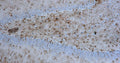 Immunohistochemistry for detection of GFAP in rat hippocampus using anti-GFAP antibody clone N206A/8 (Cat. 75-240) and Streptavidin/Biotin-ABC-Peroxidase Staining Kit (Cat. IH-8106). Tissue was fixed with 4% paraformaldehyde and paraffin embedded. Heat induced antigen retrieval was performed using citrate buffer (Cat. AR-6544) and then blocked with Immuno Protein Blocking Solution with Goat Serum (AR-6591). After washing, the primary antibody (Cat. 75-240) was incubated with the sample at a dilution of 1:500 at 4C overnight. Then the biotinylated goat anti-mouse secondary antibody was incubated with the tissue sample. Detection was made using Streptavidin/Biotin-ABC-Peroxidase Staining Kit (" target="_blank">Cat. IH-8106).