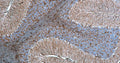 Immunohistochemistry for detection of GFAP in rat cerebellum using anti-GFAP antibody clone N206A/8 (Cat. 75-240) and Streptavidin/Biotin-ABC-Peroxidase Staining Kit (Cat. IH-8106). Tissue was fixed with 4% paraformaldehyde and paraffin embedded. Heat induced antigen retrieval was performed using citrate buffer (Cat. AR-6544) and then blocked with Immuno Protein Blocking Solution with Goat Serum (AR-6591). After washing, the primary antibody (Cat. 75-240) was incubated with the sample at a dilution of 1:500 at 4C overnight. Then the biotinylated goat anti-mouse secondary antibody was incubated with the tissue sample. Detection was made using Streptavidin/Biotin-ABC-Peroxidase Staining Kit (" target="_blank">Cat. IH-8106).