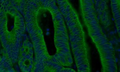 Fluorescent IHC validation: Colon Cancer FFPE sections. Primary antibody: Cytokeratin (Cat. MM-1023) antibody shown staining the epithelial cells (Green). Secondary Antibody, Goat anti- mouse 488 (Cat. 80-2001-488). The sections were mounted using Fluoroshield with DAPI and DABCO (DAPI stains nucleus in blue) (Cat. AR-6505). ​