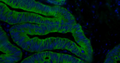 Fluorescent IHC validation: Colon Cancer FFPE sections. Primary antibody: Cytokeratin (Cat. MM-1023) antibody shown staining the epithelial cells (Green). Secondary Antibody, Goat anti-mouse 488 (Cat. 80-2001-488). The sections were mounted using Fluoroshield with DAPI and DABCO (DAPI stains nucleus in blue) (Cat. AR-6505).