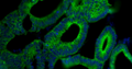 Fluorescent IHC validation: Colon Cancer FFPE sections. Primary antibody: Cytokeratin (Cat. MM-1023) antibody shown staining the epithelial cells (Green). Secondary Antibody, Goat anti- mouse 488 (Cat. 80-2001-488). The sections were mounted using Fluoroshield with DAPI and DABCO (DAPI stains nucleus in blue) (Cat. AR-6505).
