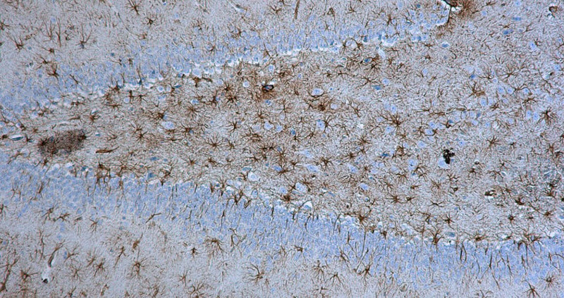 Immunohistochemistry for detection of GFAP in rat hippocampus using anti-GFAP antibody clone N206A/8 (Cat. 75-240) and Streptavidin/Biotin-ABC-Peroxidase Staining Kit (Cat. IH-8106). Tissue was fixed with 4% paraformaldehyde and paraffin embedded. Heat induced antigen retrieval was performed using citrate buffer (Cat. AR-6544) and then blocked with Immuno Protein Blocking Solution with Goat Serum (AR-6591). After washing, the primary antibody (Cat. 75-240) was incubated with the sample at a dilution of 1:500 at 4C overnight. Then the biotinylated goat anti-mouse secondary antibody was incubated with the tissue sample. Detection was made using Streptavidin/Biotin-ABC-Peroxidase Staining Kit (" target="_blank">Cat. IH-8106).