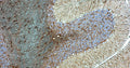 Immunohistochemistry for detection of GFAP in rat cerebellum using anti-GFAP antibody clone N206A/8 (Cat. 75-240) and Streptavidin/Biotin-ABC-Peroxidase Staining Kit (Cat. IH-8106). Tissue was fixed with 4% paraformaldehyde and paraffin embedded. Heat induced antigen retrieval was performed using citrate buffer (Cat. AR-6544) and then blocked with Immuno Protein Blocking Solution with Goat Serum (AR-6591). After washing, the primary antibody (Cat. 75-240) was incubated with the sample at a dilution of 1:500 at 4C overnight. Then the biotinylated goat anti-mouse secondary antibody was incubated with the tissue sample. Detection was made using Streptavidin/Biotin-ABC-Peroxidase Staining Kit (" target="_blank">Cat. IH-8106).
