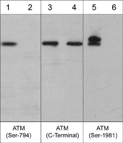 Immunocytochemical labeling of ATM phosphorylation in calyculin A-treated A431 cells. The cells were labeled with rabbit polyclonal anti-ATM (Ser-794) (AP3631) antibody in the absence (Left) or presence (Right) of blocking peptide (AX3635). The antibody was detected using appropriate secondary antibody conjugated to DyLight® 594.