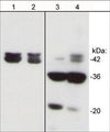 Western blot analysis of mouse C2C12 cells untreated (lanes 1 & 3), or treated with pervanadate (1 mM) for 30 min (lanes 2 & 4). The blot was probed with anti-Actin (N-terminal) antibody (lanes 1 & 2) or anti-Actin (Tyr-53) antibody (lanes 3 & 4).