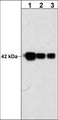 Western blot analysis of mouse C2C12 cells probed with mouse monoclonal anti-Actin (C-terminal region) antibody at 1:1000 (lane 1), 1:2000 (lane 2), or 1:4000 (lane 3).
