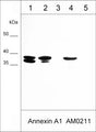 Western blot of human A431 cells (lane 1), A549 cells (lane 2), LNCaP cells (lane 3), full-length recombinant human annexin A1 (lane 4), and recombinant human annexin A2 (lane 5). The blot was probed with mouse monoclonal anti-Annexin A1 antibody (AM0211) at 1:1000 (lanes 1-5).