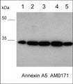 Western blot of human PC3 cells (lane 1), human breast tissue (lane 2), lung tissue (lane 3), skin tissue (lane 4), and brain tissue (lane 5). The blot was probed with mouse monoclonal anti-Annexin A5 antibody (AM0171) at 1:500 (lanes 1-5).