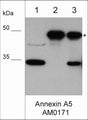 Western blot of A431 cell lysate only (lane 1), AM0171 antibody only (lane 2), and AM0171 antibody immunoprecipitate from A431(lane 3). The blot was probed with mouse monoclonal anti-Annexin A5 antibody (AM0171) at 1:500 (lanes 1-3). The asterisk shows the antibody heavy chain in immunopreciptates at 50 kDa, while Annexin A5 band is observed at 35 kDa.