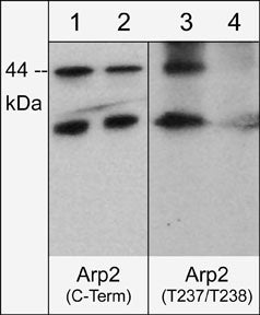 Western blot of human A431 cells treated with Calyculin A (100 nM) for 30 min. Blot lanes were untreated (lanes 1 & 3) or treated with lambda phosphatase (lanes 2 & 4) then probed with anti-Arp2 (C-terminal) (lanes 1 & 2) or anti-Arp2 (Thr-237/Thr-238) (lanes 3 & 4).