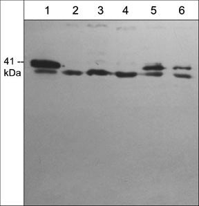 Western blot of rat A7r5 (lane 1), human Jurkat (lane 2), rat PC12 (lane 3), human PC3 (lane 4), mouse C2C12 (lane 5), and human A431 cells (lane 6). The blot was probed with rabbit polyclonal anti-Arpc1b (C-terminal region).
