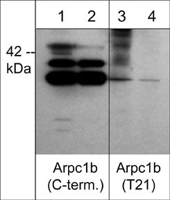 Western blot analysis of Arpc1b phosphorylation in human A431 stimulated with calyculin A (100 nM) for 30 min (lanes 1 & 3). The blots were treated with lambda phosphatase to remove phosphorylation (lanes 2 & 4), then probed with anti-Arpc1b (C-terminal region) (lanes 1 & 2) or anti-Arpc1b (Thr-21) (lanes 3 & 4).