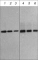 Western blot image of human recombinant Atrogin 1 (lanes 1-6). The blot was probed with rabbit polyclonal Atrogin-1 (lanes 1-3) and rat monoclonal Atrogin-1 (lanes 4-6) at 1:1000 (lanes 1 & 4), 1:2000 (lanes 2 & 5), and 1:4000 (lanes 3 & 6).