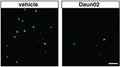 Transgenic rats that received vehicle (left panel) or Daun02 (right panel) were perfused 90 min after the last CS1 presentation and analyzed for the expression of β-galactosidase (β-gal) (Cat. BGL, 1:1000). Image from publication CC-BY-4.0. PMID:38656872
