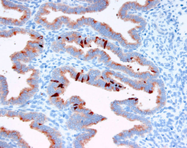 Immunohistochemistry detection of Placental protein 14 in human endometrial tissue tissue using Anti-Placental Protein 14 Antibody (Cat. BTE 001-16-010). Tissue was mounted and pariffin fixed. Heat induced antigen retrieval was performed using citrate buffer, heated, and then blocked. After washing, the primary antibody (Cat. BTE 001-16-010) was incubated with the sample. Staining is restricted to the glandular cells from the late secretory phase.