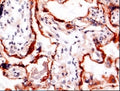 Immunohistochemistry detection of Pregnancy associated plasma protein A (PAPP-A) in human placenta tissue using Anti-Pregnancy Associated Plasma Protein A (PAPP-A) Antibody (Cat. BTE 004-09-010). Tissue was mounted and pariffin fixed. Heat induced antigen retrieval was performed using citrate buffer, heated, and then blocked. After washing, the primary antibody (Cat. BTE 004-09-010) was incubated with the sample. Staining is restricted to the syncytiotrophoblast of the chorionic villi.