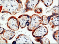 Immunohistochemistry detection of Pregnancy associated plasma protein A (PAPP-A) in human placenta tissue using Anti-Pregnancy Associated Plasma Protein A (PAPP-A) Antibody (Cat. BTE 004-09-010). Tissue was mounted and pariffin fixed. Heat induced antigen retrieval was performed using citrate buffer, heated, and then blocked. After washing, the primary antibody (Cat. BTE 004-09-010) was incubated with the sample. Staining is restricted to the syncytiotrophoblast of the chorionic villi.