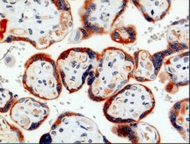 Immunohistochemistry detection of Pregnancy associated plasma protein A (PAPP-A) in human placenta tissue using Anti-Pregnancy Associated Plasma Protein A (PAPP-A) Antibody (Cat. BTE 004-09-010). Tissue was mounted and pariffin fixed. Heat induced antigen retrieval was performed using citrate buffer, heated, and then blocked. After washing, the primary antibody (Cat. BTE 004-09-010) was incubated with the sample. Staining is restricted to the syncytiotrophoblast of the chorionic villi.