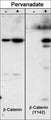 Western blot analysis of Hct116 src transformed cells (20 µg/lane) serum starved overnight or treated with pervanadate (1 mM) for 30 min. The blot was probed with anti-β-Catenin or anti-β-Catenin (Tyr-142).