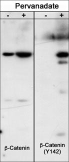 Western blot analysis of Hct116 src transformed cells (20 µg/lane) serum starved overnight or treated with pervanadate (1 mM) for 30 min. The blot was probed with anti-β-Catenin or anti-β-Catenin (Tyr-142).