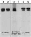 Western blot analysis of A431 cells stimulated with pervanadate (1 mM) for 30 min (lanes 1, 3, & 5) then treated with akaline phosphatase (lanes 2, 4, & 6). The blot was probed with anti-γ-Catenin (CM1111), anti-β-Catenin (Tyr-489) conserved site (CP2961), or anti-β-Catenin (CM1181).
