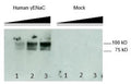 Western blot detection of SCNN1G/Gamma-Subunit Epithelial Sodium Channel using Anti-SCNN1G/Gamma-Subunit Epithelial Sodium Channel Antibody (Cat. CAM 003-07-010). Gel was loaded with HEK293 cells transfected with and without γENaC. Lane 1 loaded with 5µg, Lane 2 loaded with 10µg, Lane 3 loaded with 20 µg. Proteins were transferred to the membrane, blocked, and then washed with a buffer. Primary antibody was incubated with sample and then detected via ECL using a secondary antibody.