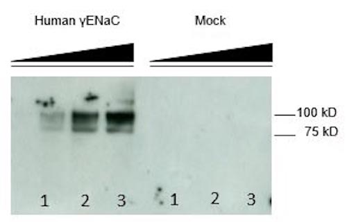 Western blot detection of SCNN1G/Gamma-Subunit Epithelial Sodium Channel using Anti-SCNN1G/Gamma-Subunit Epithelial Sodium Channel Antibody (Cat. CAM 003-07-010). Gel was loaded with HEK293 cells transfected with and without γENaC. Lane 1 loaded with 5µg, Lane 2 loaded with 10µg, Lane 3 loaded with 20 µg. Proteins were transferred to the membrane, blocked, and then washed with a buffer. Primary antibody was incubated with sample and then detected via ECL using a secondary antibody.
