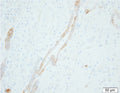 Immunohistochemistry detection of SCNN1G/Gamma-Subunit Epithelial Sodium Channel in human kidney tissue using Anti-SCNN1G/Gamma-Subunit Epithelial Sodium Channel Antibody (Cat. CAM 005-02B-015). Tissue was mounted and pariffin fixed. Heat induced antigen retrieval was performed using citrate buffer, heated, and then blocked. After washing, the primary antibody (Cat. CAM 005-02B-015) was incubated with the sample. Courtesy of Per Svenningsen, PhD.