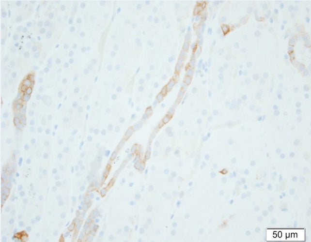 Immunohistochemistry detection of SCNN1G/Gamma-Subunit Epithelial Sodium Channel in human kidney tissue using Anti-SCNN1G/Gamma-Subunit Epithelial Sodium Channel Antibody (Cat. CAM 005-02B-015). Tissue was mounted and pariffin fixed. Heat induced antigen retrieval was performed using citrate buffer, heated, and then blocked. After washing, the primary antibody (Cat. CAM 005-02B-015) was incubated with the sample. Courtesy of Per Svenningsen, PhD.